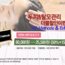 독일WT메소드