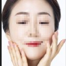 미스킨바디 이미지