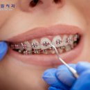 연세필치과교정과 이미지