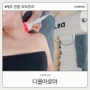 디올아로마
