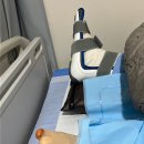 크린워커 | 5탄) 35년 된 무지외반증환자의 찐 후기!!! MICA(무지외반증 수술)양측dl +MBO(발목인대봉합술)우측