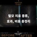 멘토의원