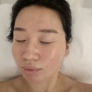 밝음메디 | 김해에스테틱 장유에스테틱 더밝음메디에스테틱 특수관리 문제성피부관리 홍조피부관리 후기