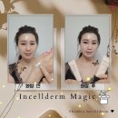 물광피부 인셀덤