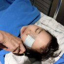 눈누네일 | 대구 누네안과 소아사시수술 수술 당일 후기 2탄