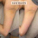 스퍼트 - 광주시 숯골길 99 | 결혼 10일 전 예신의 마곡 웨딩관리 5회차, 막바지 스퍼트 후기, 3가지 필링 레이어드 아이스크림필 관리