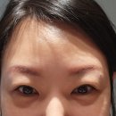 완주 봉동읍 미우브로우에서 눈썹 문신 제거 3회차 후기! 💡