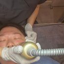 부산마이크로병원 | 부산새살침 한의원 패인흉터 채우고 모공 피부결 레이저 2회차