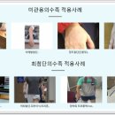 신세계 의수족 연구소 이미지