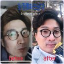 볼륨톡스/임상테스트완료/후기사진들보고가세용/써본사람들은반한다
