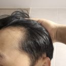 지에이치(GH)자연건강 | 쿠니 탈모완화샴푸 후기 M자 고민으로 써본 비건 기능성 샴푸