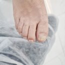 부평 내성발톱 레푸스부평CGV점 추천하는 이유