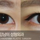 강남미의원 이미지