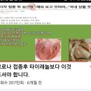 3차접종-코로나접종후 이런증상있으면 타이레놀보다 진통소염제 이미지