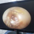 뉴이어보청기(대구센터) | 대구수성구보청기 청력검사부터 보청기사후관리까지 꼼꼼하게 살펴본 후기^^