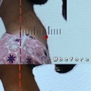 살루스한의원 네이버블로그