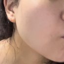 진정 | 이니스프리 화산송이 폼 피부 트러블 진정 관리후기