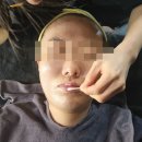 7183 | 대봉동에스테틱 솔에스테틱 수분탄력 후기