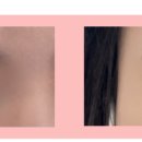 아이오니 뷰티(IONI BEAUTY) 네이버블로그