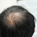 뉴헤어뱅크 - 중구 | 뉴헤어뱅크