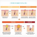 포이즌의원 이미지