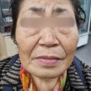[엘뤼프 리얼후기] 60대 여성 3주 사용 후기