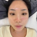 리아아파트 및 상가 | [리벨르스킨 방문기] 창원, 마산 피부관리로 여드름, 문제성피부 싹 케어했어요!