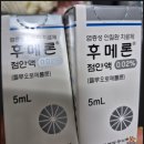 인천 올레이저 투데이라섹 수술후 2,3,4,5일차 보호렌즈제거 2주,한달차 내돈내산 후기