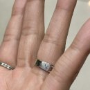 이봉구피부과의원 | [분당/수내역] 피부질환치료 / 손바닥세로주름 주부습진 피부습진 이봉구 피부과의원 진료후기