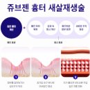 화금화장실 | 피부/팔자주름] 젊어지고 싶은 것은 모두의 바람. 가장 효과적인 팔자 주름 공략! 쥬브젠 후기