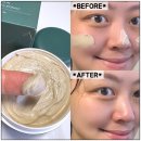 카올 - 성남시 수정구 복정로32번길 38 | 여드름전용팩, < 닥터듀 : 카올징크 여드름팩 > 솔직후기!!