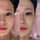 수화 | [송파] 가락동 피부관리 &#39;쁘에르 에스테틱&#39; 트러블 예민피부 수화강테라피 후기