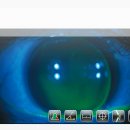 010안경콘택트 이미지