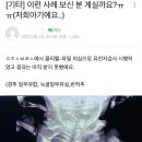 [일반] 새로운 기형 발견.. ‘반척추’ ‘윌리엄스증후군’ 이미지