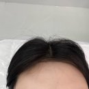 퓨어리티(Purity) | 당진 읍내동 신상 왁싱샵 퓨어리티 헤어라인왁싱 후기 (전후사진, 이벤트)