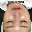 하영피부관리 이미지