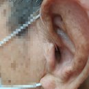 시그니아독일보청기 의정부센터 이미지