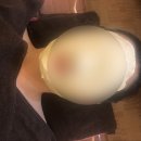 루디아피부비만관리