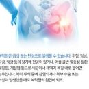 간경변증 문맥 고혈압 복수 발생 원인 증상 복막염 이미지