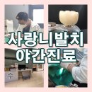 죽곡연합치과의원 | 구미 형곡동 치과 사랑니 발치 당일 매복사랑니 잘하는곳