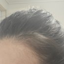 [내돈내산]릴리이브 그로우턴 앰플 후기_2통사용