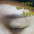 골드슈가링