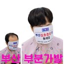 부산 부분가발, 남녀 모두 감쪽같이 커버하는 비밀템