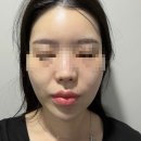 온에스테틱 아카데미 | 상동 학생여드름 성인여드름 관리 잘하는 민에스테틱 솔직 후기