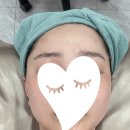 윤스메디칼 | 청주피부관리 l 지웰시티피부관리 l 리프에스테틱에서 뱀부테라피 받은 후기