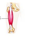 대퇴직근 (RECTUS FEMORIS) 이미지