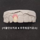 최강치과기공소 이미지