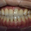 멍크라운 이미지