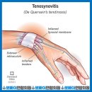 뽀빠이PC 이미지