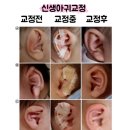 최병기재활의학과의원 | [신생아 귀교정] 임신영 재활의학과의원 내돈내산 후기 #1 - 예약부터 첫 진료까지 (가격 정보 포함)
